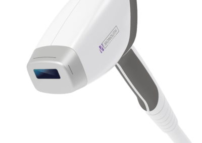Ministry-of-Beauty-Diodenlaser-Haarentfernung-Equipment-Geraete