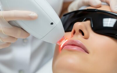 Diodenlaser: Die Überlegene Wahl zur Damenbart-Entfernung